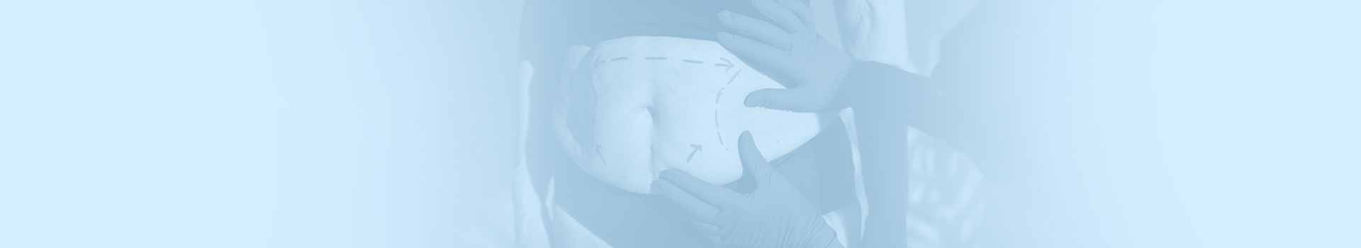 Bariatric surgery consultation and planning in Istanbul
